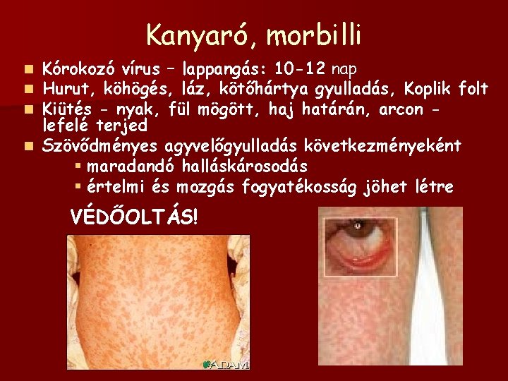 Kanyaró, morbilli Kórokozó vírus – lappangás: 10 -12 nap Hurut, köhögés, láz, kötőhártya gyulladás,