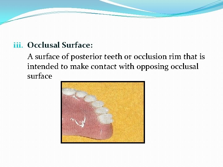 Introduction to Removable Prosthodontics Complete Denture PROSTHODONTICS Acc