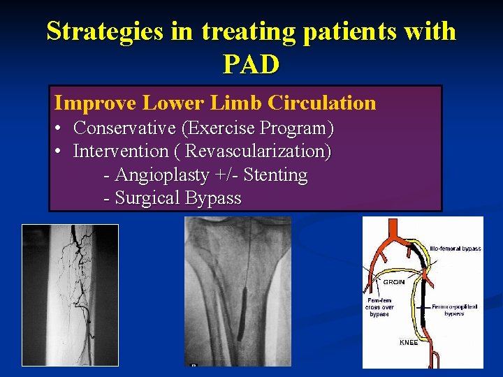 Strategies in treating patients with PAD Improve Lower Limb Circulation • Conservative (Exercise Program)