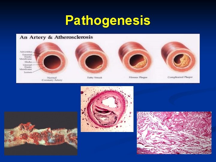 Pathogenesis 