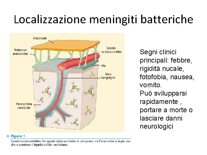 Localizzazione meningiti batteriche Segni clinici principali: febbre, rigidità nucale, fotofobia, nausea, vomito. Può svilupparsi