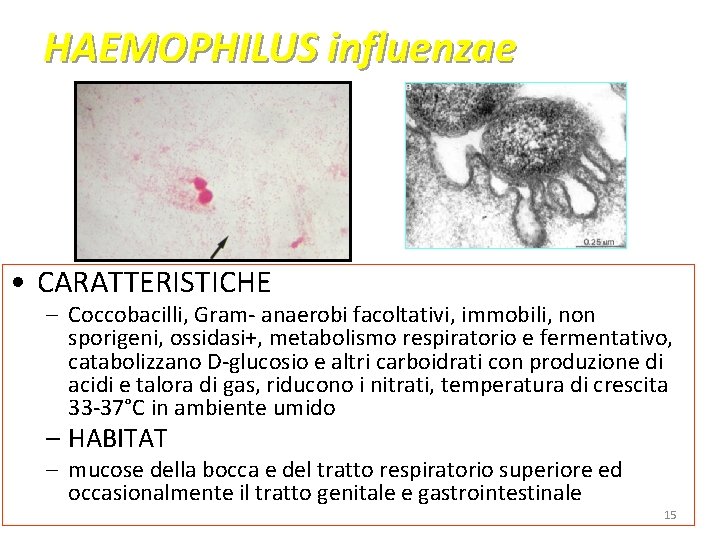 HAEMOPHILUS influenzae • CARATTERISTICHE – Coccobacilli, Gram- anaerobi facoltativi, immobili, non sporigeni, ossidasi+, metabolismo