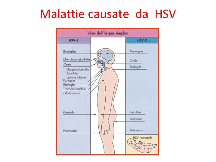 Malattie causate da HSV 