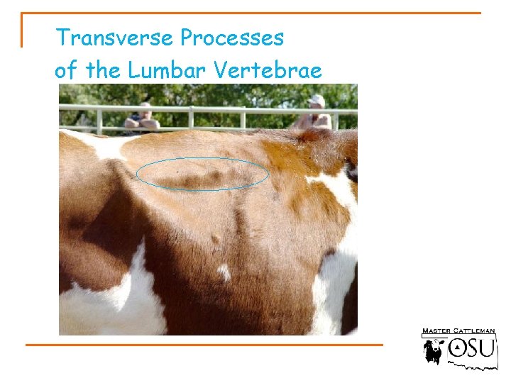 Transverse Processes of the Lumbar Vertebrae 