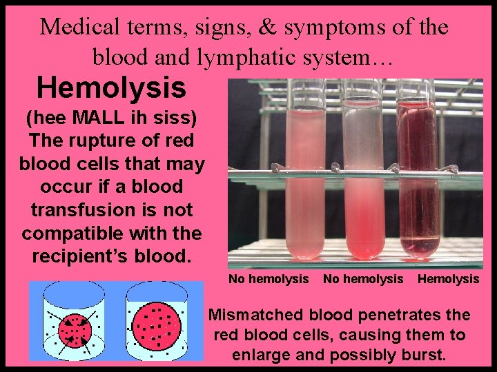 Medical terms, signs, & symptoms of the blood and lymphatic system… Hemolysis (hee MALL