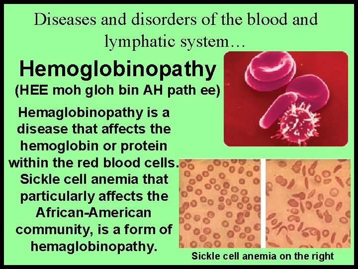 Diseases and disorders of the blood and lymphatic system… Hemoglobinopathy (HEE moh gloh bin
