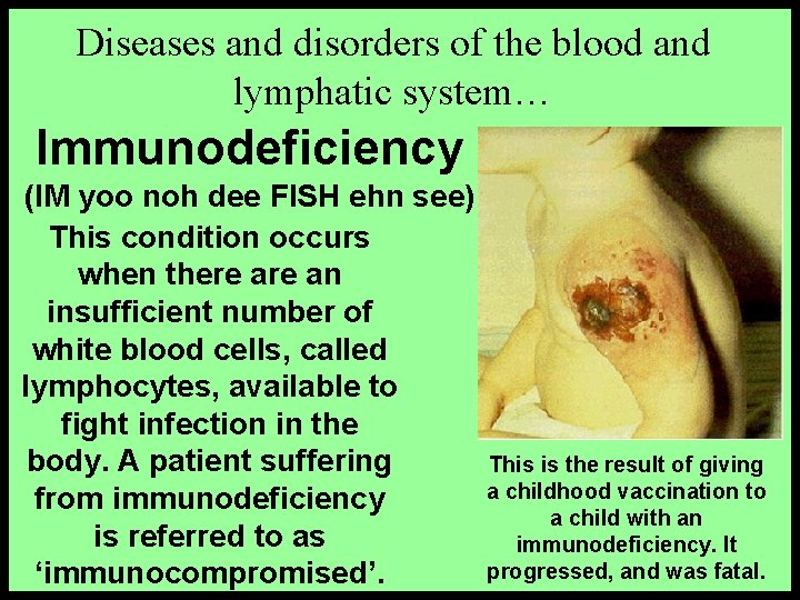 Diseases and disorders of the blood and lymphatic system… Immunodeficiency (IM yoo noh dee