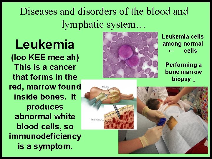 Diseases and disorders of the blood and lymphatic system… Leukemia (loo KEE mee ah)