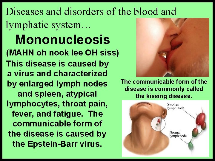 Diseases and disorders of the blood and lymphatic system… Mononucleosis (MAHN oh nook lee