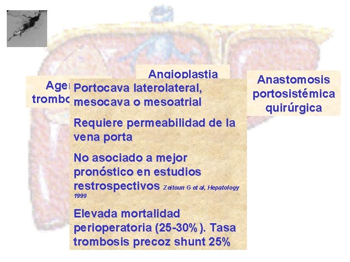Angioplastia Agentes Portocava laterolateral, trombolíticos mesocava o mesoatrial Requiere permeabilidad de la vena porta