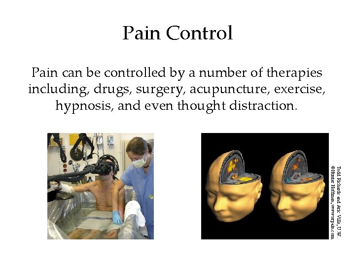 Pain Control Pain can be controlled by a number of therapies including, drugs, surgery,