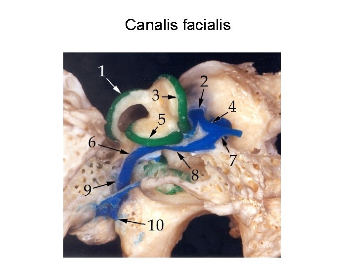 Canalis facialis 