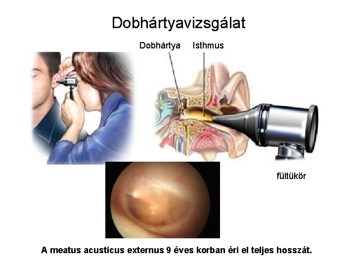 Dobhártyavizsgálat Dobhártya Isthmus fültükör A meatus acusticus externus 9 éves korban éri el teljes