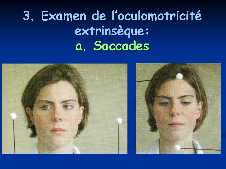 3. Examen de l’oculomotricité extrinsèque: a. Saccades 3. Examen de l’oculomotricité extrinsèque: a. Saccades