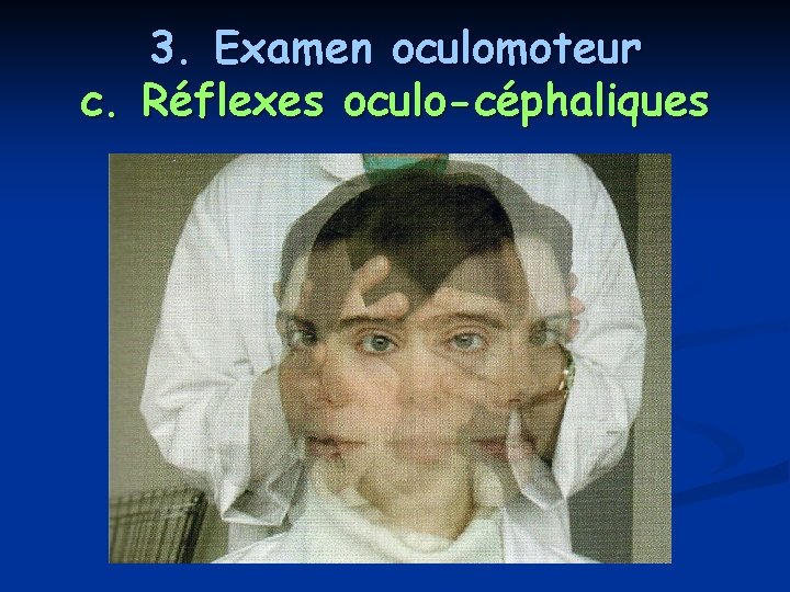 3. Examen oculomoteur c. Réflexes oculo-céphaliques 3. Examen oculomoteur c. Réflexes oculo-céphaliques