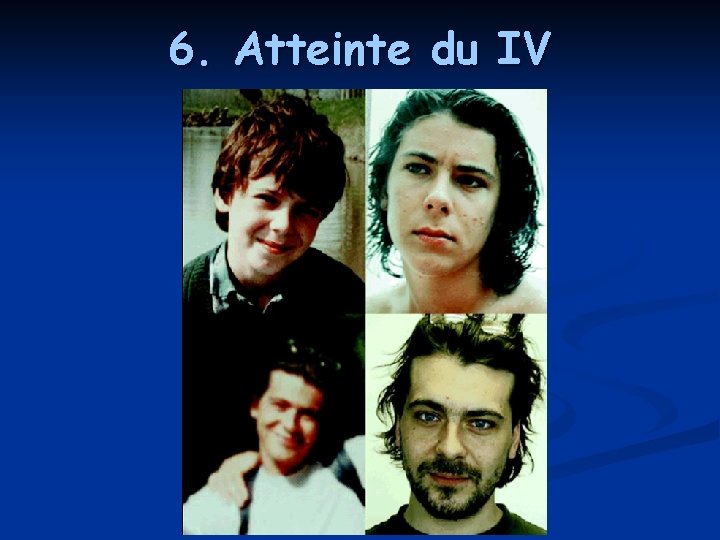 6. Atteinte du IV 6. Atteinte du IV