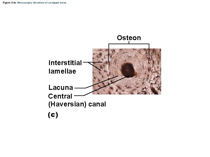 Figure 5. 4 c Microscopic structure of compact bone. Osteon Interstitial lamellae Lacuna Central Figure 5. 4 c Microscopic structure of compact bone. Osteon Interstitial lamellae Lacuna Central