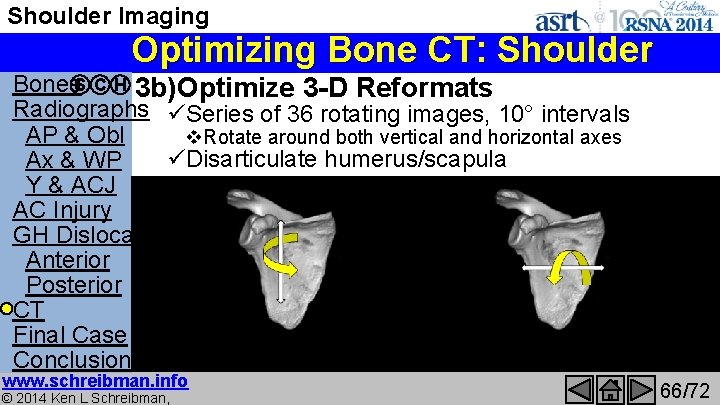 Shoulder Imaging Optimizing Bone CT: Shoulder Bones. S C H 3 b)Optimize 3 -D