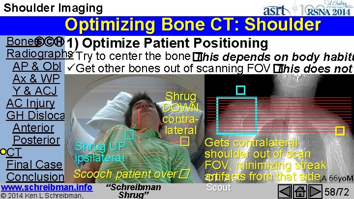 Shoulder Imaging Optimizing Bone CT: Shoulder Bones. S C H 1) Optimize Patient Positioning