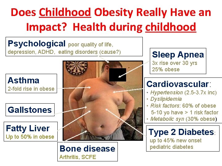 Does Childhood Obesity Really Have an Impact? Health during childhood Psychological poor quality of