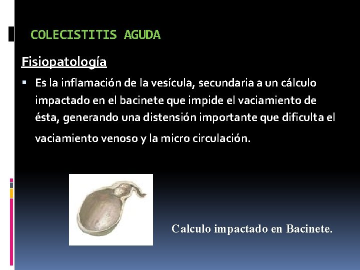 COLECISTITIS AGUDA Fisiopatología Es la inflamación de la vesícula, secundaria a un cálculo impactado