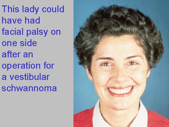 This lady could have had facial palsy on one side after an operation for