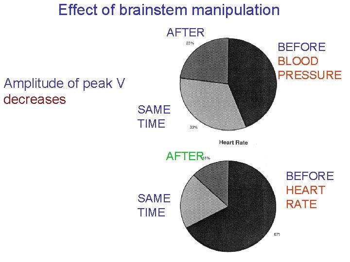 Effect of brainstem manipulation AFTER Amplitude of peak V decreases BEFORE BLOOD PRESSURE SAME