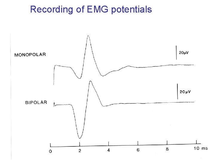 Recording of EMG potentials 