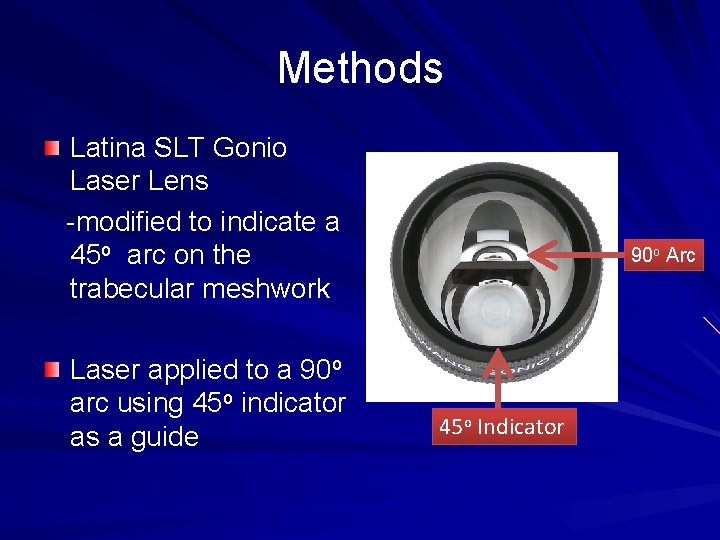 Methods Latina SLT Gonio Laser Lens -modified to indicate a 45 o arc on