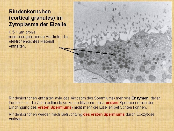 Rindenkörnchen (cortical granules) im Zytoplasma der Eizelle 0, 5 -1 mm große, membrangebundene Vesikeln,
