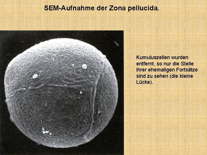 SEM-Aufnahme der Zona pellucida. Kumuluszellen wurden entfernt, so nur die Stelle ihrer ehemaligen Fortsätze