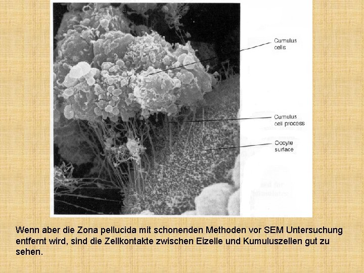 Wenn aber die Zona pellucida mit schonenden Methoden vor SEM Untersuchung entfernt wird, sind