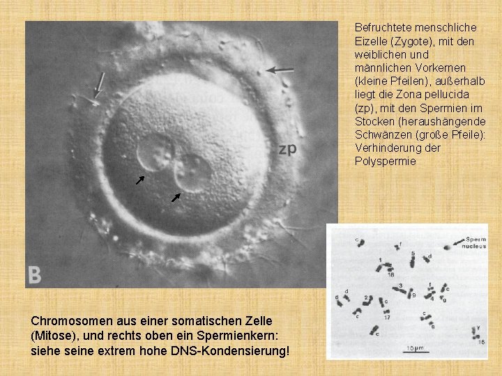 Befruchtete menschliche Eizelle (Zygote), mit den weiblichen und männlichen Vorkernen (kleine Pfeilen), außerhalb liegt