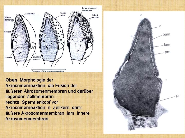 Oben: Morphologie der Akrosomenreaktion; die Fusion der äußeren Akrosomenmembran und darüber liegenden Zellmembran. rechts: