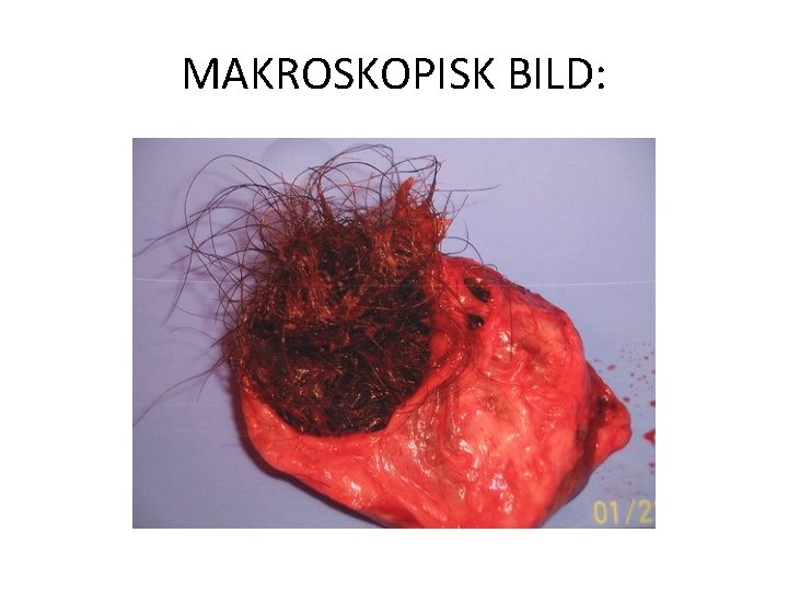 MAKROSKOPISK BILD: 