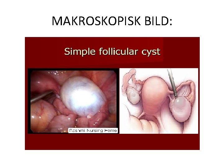 MAKROSKOPISK BILD: 