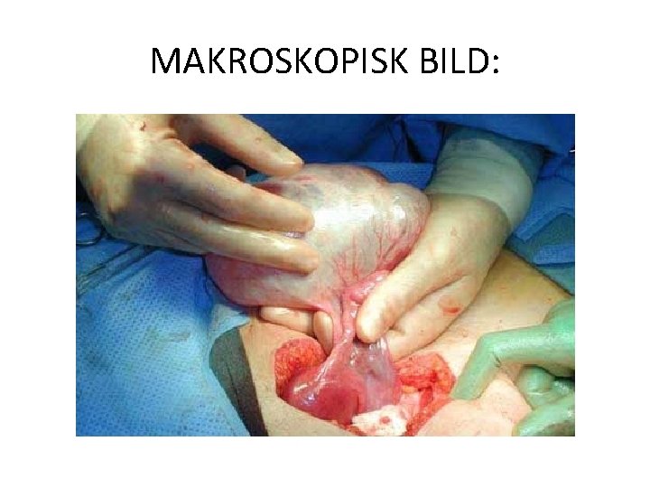 MAKROSKOPISK BILD: 