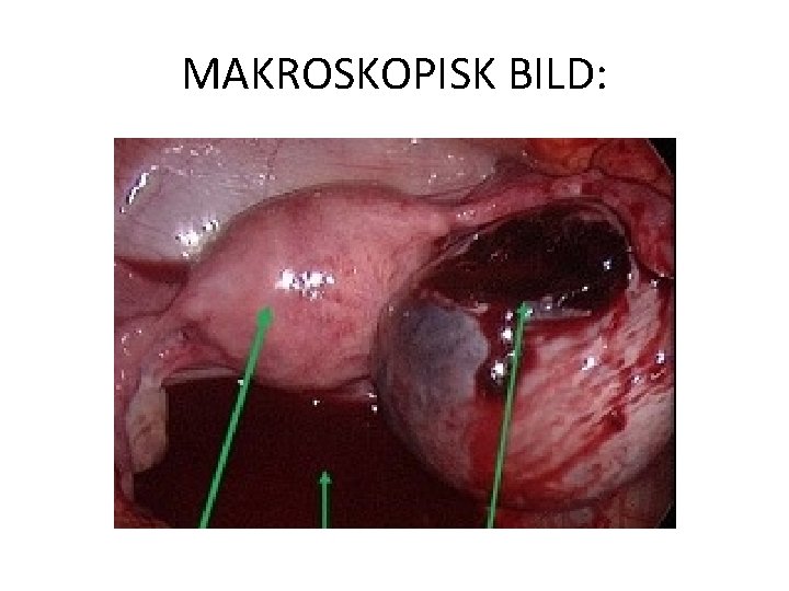 MAKROSKOPISK BILD: 