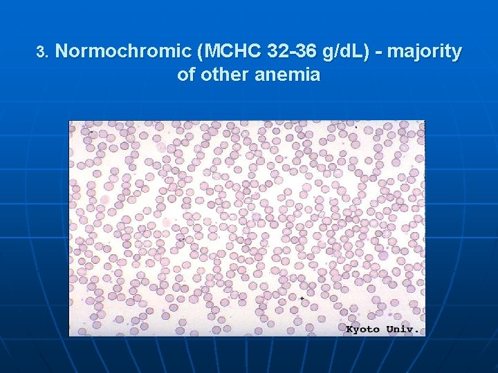 3. Normochromic (MCHC 32 -36 g/d. L) - majority of other anemia 