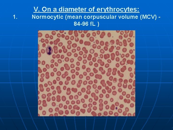 V. On a diameter of erythrocytes: 1. Normocytic (mean corpuscular volume (MCV) 84 -96