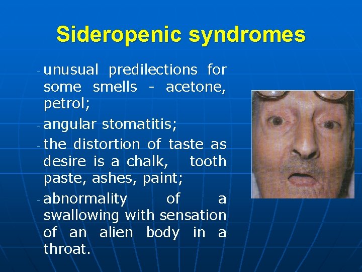 Sideropenic syndromes unusual predilections for some smells - acetone, petrol; - angular stomatitis; -