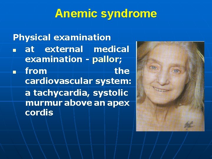 Anemic syndrome Physical examination n at external medical examination - pallor; n from the