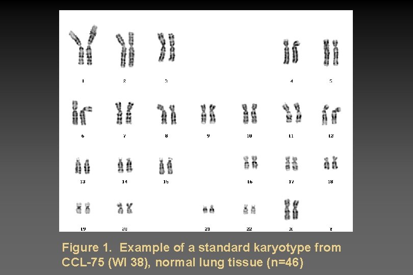 Figure 1. Example of a standard karyotype from CCL-75 (WI 38), normal lung tissue