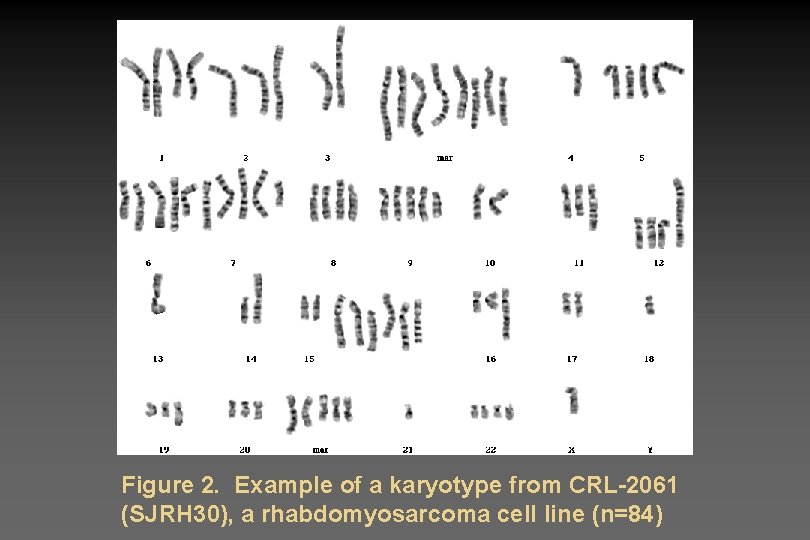 Figure 2. Example of a karyotype from CRL-2061 (SJRH 30), a rhabdomyosarcoma cell line