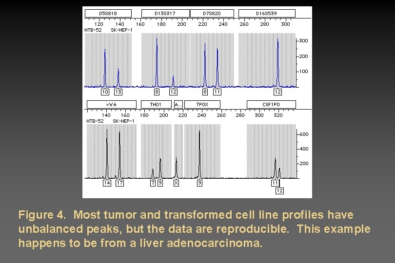 Figure 4. Most tumor and transformed cell line profiles have unbalanced peaks, but the