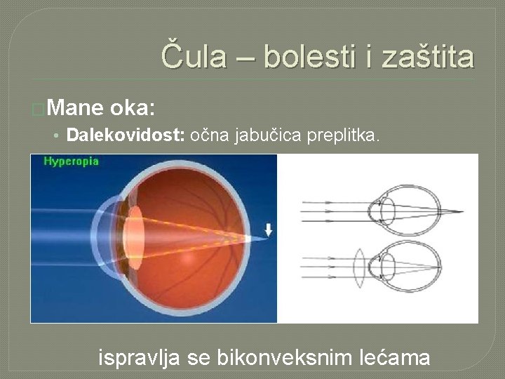 Čula – bolesti i zaštita �Mane oka: • Dalekovidost: očna jabučica preplitka. ispravlja se