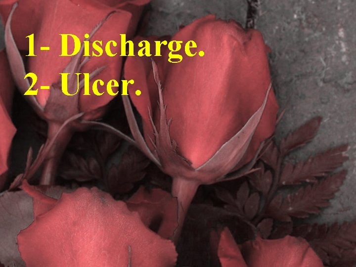 1 - Discharge. 2 - Ulcer. 
