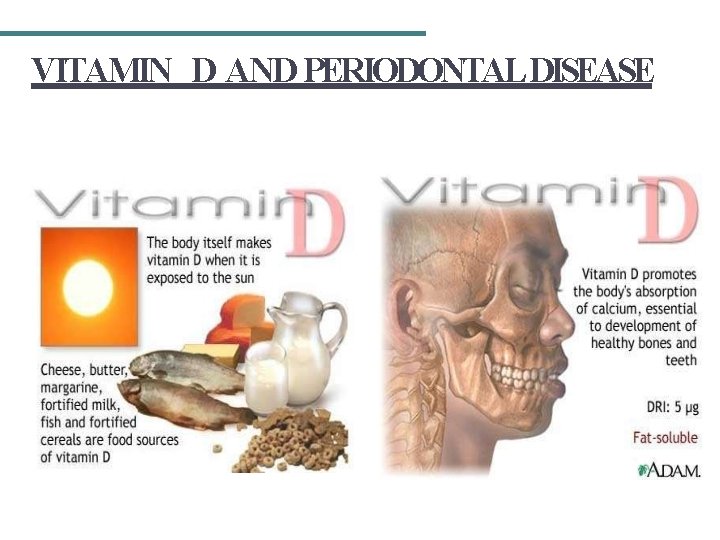 VITAMIN D AND PERIODONTAL DISEASE 