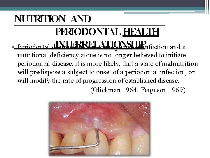 NUTRITION AND PERIODONTAL HEALTH INTERRELATIONSHIP • Periodontal destruction is a consequence of infection and
