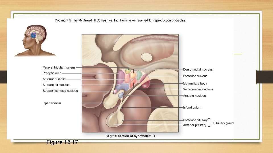 Figure 15. 17 